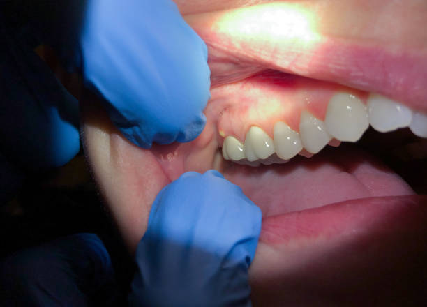 Best Mobile Emergency Dentist in Santa Maria, CA