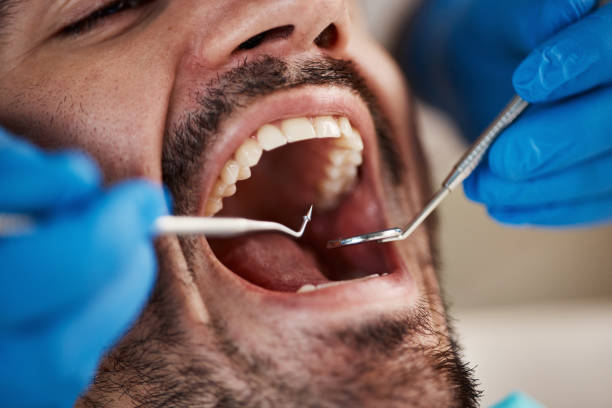Best Broken or Cracked Tooth Emergency Dentist in Santa Maria, CA
