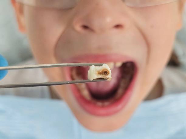 Best Orthodontic Emergency Dentist in Santa Maria, CA