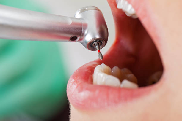 Best Emergency Cosmetic Dentistry in Santa Maria, CA